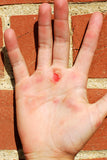 Rip Guardian - Rip and Blister Protection Patches (4385483751490)